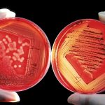 Bakterije tolerantne na jedan antibiotik će vjerovatno razviti rezistentnost