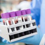 Otkriven novi test krvi koji može da detektuje 50 različitih vrsta raka