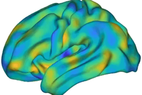 Karakteristični nabori ljudskog mozga utiču na njegovo funkcionisanje