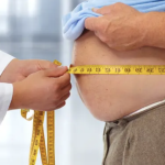 Epidemija gojaznosti:  „Svjetski trendovi i potraga za rješenjem“